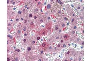 Anti-GSTA1 antibody IHC of human liver. (GSTA1 antibody  (AA 1-222))
