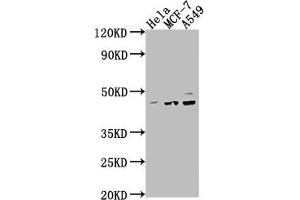 PRKACA antibody  (Catalytic Subunit alpha)