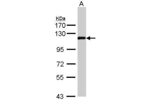 ZHX2 Antikörper  (C-Term)
