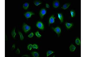 Immunofluorescence staining of A549 cells with ABIN7172278 at 1:166, counter-stained with DAPI. (TLR6 antibody  (AA 32-586))