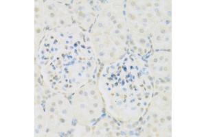 Immunohistochemistry of paraffin-embedded rat kidney using KAT2A antibody (ABIN5971244) at dilution of 1/100 (40x lens).
