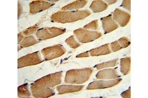 IHC analysis of FFPE human skeletal muscle stained with SMAD4 antibody (SMAD4 antibody  (AA 400-428))