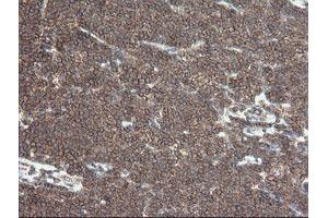 Image no. 1 for anti-Differentially Expressed in FDCP 6 Homolog (DEF6) antibody (ABIN1497810) (DEF6 antibody)