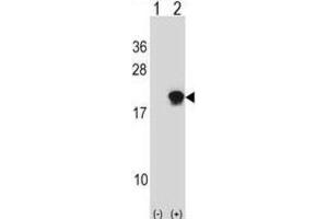 Western Blotting (WB) image for anti-Small Ubiquitin Related Modifier 4 (SUMO4) antibody (ABIN2996865) (SUMO4 antibody)