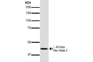 Western Blot analysis of Mouse Brain showing detection of ~40 kDa Nav Beta 3 protein using Mouse Anti-Nav Beta 3 Monoclonal Antibody, Clone S396-29 . (SCN3B antibody  (AA 1-215))
