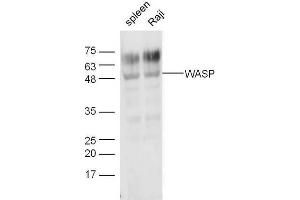 Lane 1: Mouse spleen lysates, Lane 2: Raji lysates, probed with Anti-WASP Polyclonal Antibody at 1:5000 90min in 37˚C. (WASP antibody  (AA 101-200))