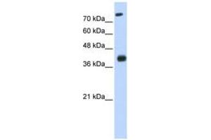 Image no. 1 for anti-ISL LIM Homeobox 2 (ISL2) (N-Term) antibody (ABIN6742917)