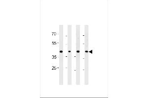 Western blot analysis in PC-3 cell line and mouse brain,testis and liver lysates (35ug/lane). (CABLES2 antibody  (AA 182-210))