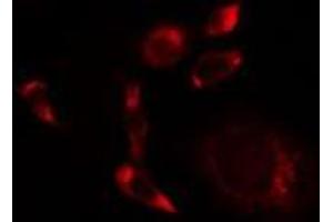 ABIN6275514 staining A549 cells by IF/ICC. (SCFD1 antibody  (C-Term))