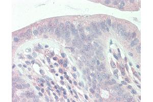 Anti-SLC9A1BP / CHP antibody IHC staining of human colon. (CHP antibody  (AA 35-84))