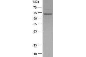 Western Blotting (WB) image for Nuclear Factor of kappa Light Polypeptide Gene Enhancer in B-Cells 1 (NFKB1) (AA 2-434) protein (His tag) (ABIN7285575) (NFKB1 Protein (AA 2-434) (His tag))