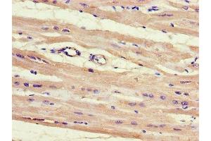 Immunohistochemistry of paraffin-embedded human heart tissue using ABIN7155128 at dilution of 1:100