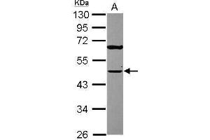 WB Image Sample (30 ug of whole cell lysate) A: A431 , 10% SDS PAGE antibody diluted at 1:2000 (TUFM antibody)