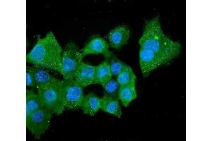 IF analysis of ALDH2 using anti-ALDH2 antibody (ABIN7603107). (ALDH2 antibody  (N-Term))