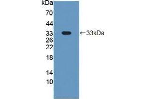 Detection of Recombinant GP1Ba, Mouse using Polyclonal Antibody to Cluster Of Differentiation 42b (CD42b) (CD42b antibody  (AA 17-282))