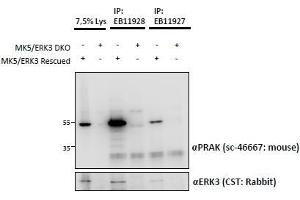 ABIN1590011 and EB11928 (1. (MAPKAP Kinase 5 antibody  (Internal Region))