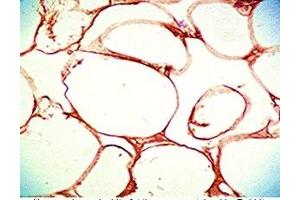 Human visceral white fat tissue was stained by Rabbit Anti-Vaspin (63-104) (Human) Serum (SERPINA12 antibody  (AA 63-104))
