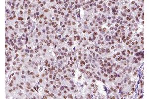 ABIN6268826 at 1/100 staining human liver tissue sections by IHC-P. (ZEB2 antibody  (N-Term))