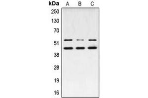 Western blot analysis of JNK1/2/3 (pT183) expression in MCF7 PMA-treated (A), NIH3T3 UV-treated (B), PC12 PMA-treated (C) whole cell lysates.