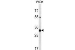 Western Blotting (WB) image for anti-Olfactory Receptor, Family 2, Subfamily W, Member 5 (OR2W5) antibody (ABIN2998137) (OR2W5 antibody)