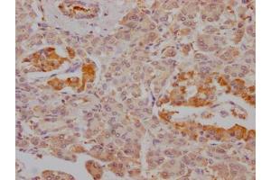 IHC image of ABIN7127485 diluted at 1:100 and staining in paraffin-embedded human pancreatic tissue performed on a Leica BondTM system. (Recombinant FBP1 antibody)