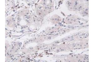 Detection of LCP1 in Human Stomach Tissue using Polyclonal Antibody to L-Plastin (LCP1)
