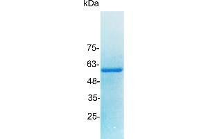 Enolase 1 (ENO1) protein (His tag)