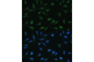 Immunofluorescence analysis of L929 cells using NUP98 antibody (ABIN1681142, ABIN3015191, ABIN3015192, ABIN5663696 and ABIN6213876) at dilution of 1:100. (NUP98 antibody  (AA 621-920))