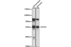 Western blot analysis of extracts of various cell lines, using FSCN2 antibody (ABIN7267143) at 1:1000 dilution. (Fascin 2 antibody  (AA 1-310))