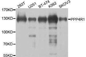 Western blot analysis of extracts of various cell lines, using PPP4R1 antibody (ABIN5974671) at 1/1000 dilution. (PPP4R1 antibody)