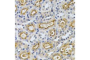 Immunohistochemistry (Paraffin-embedded Sections) (IHC (p)) image for anti-Adrenergic, Beta, Receptor Kinase 1 (ADRBK1) (AA 440-689) antibody (ABIN3022346)
