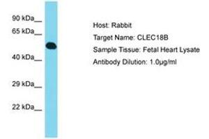 Image no. 1 for anti-C-Type Lectin Domain Family 18, Member C (CLEC18C) (AA 303-352) antibody (ABIN6750826) (CLEC18C antibody  (AA 303-352))