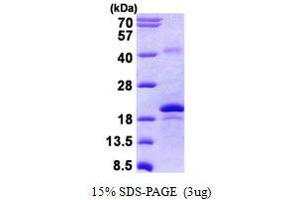 SDS-PAGE (SDS) image for Gremlin 2 (GREM2) (AA 22-168) protein (His tag) (ABIN5852925)