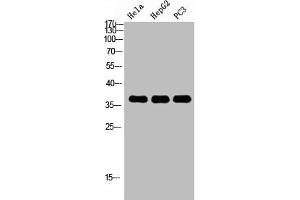 Western Blot analysis of HELA HEPG2 PC-3 using p38 Polyclonal Antibody. (MAPK14 antibody  (C-Term))