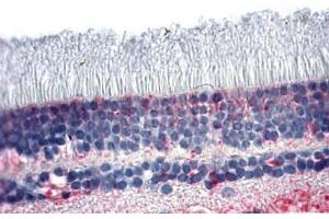 Anti-NR2E3 antibody  ABIN1049136 IHC staining of human retina.