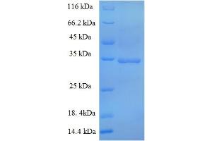 SDS-PAGE (SDS) image for S-Phase Kinase-Associated Protein 1 (SKP1) (AA 2-163) protein (GST tag) (ABIN5710368) (SKP1 Protein (AA 2-163) (GST tag))