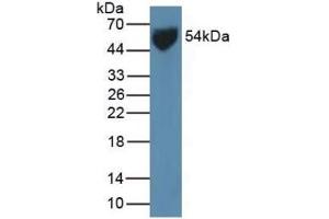 Detection of GLUT1 in Human Serum using Polyclonal Antibody to Glucose Transporter 1 (GLUT1) (GLUT1 antibody  (AA 251-329))