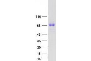 Validation with Western Blot (SPINT1 Protein (Transcript Variant 3) (Myc-DYKDDDDK Tag))