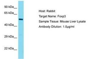 Image no. 1 for anti-Forkhead Box P3 (FOXP3) (AA 23-72) antibody (ABIN6750280)