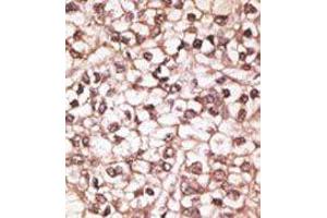 Image no. 2 for anti-ATP-Binding Cassette, Sub-Family B (MDR/TAP), Member 4 (ABCB4) (Center) antibody (ABIN358591) (ABCB4 antibody  (Center))