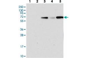 Western blot analysis of Lane 1: RT-4, Lane 2: U-251 MG, Lane 3: Human Plasma, Lane 4: Liver, Lane 5: Tonsil with PLEKHG6 polyclonal antibody . (PLEKHG6 antibody)