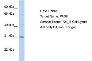 Host: Rabbit Target Name: PADI4 Sample Type: 721_B Cell lysates Antibody Dilution: 1. (PAD4 antibody  (Middle Region))