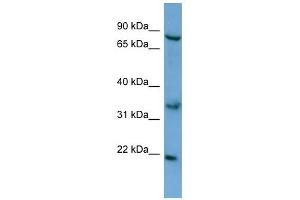 ABCD2 antibody used at 0. (CCL17 antibody  (N-Term))