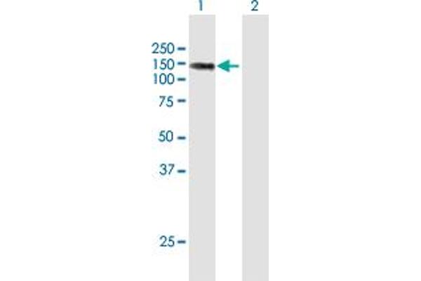 LIMCH1 Antikörper  (AA 1-897)