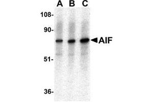 Western blot analysis of AIF in K562 with AP30031PU-N AIF antibody at (A) 0. (AIF antibody  (C-Term))
