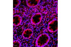 Immunofluorescence of paraffin embedded human colon using NAIF1 (ABIN7074867) at dilution of 1:650 (400x lens) (NAIF1 antibody)