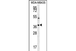 TNIP3 Antibody (N-term) (ABIN651787 and ABIN2840400) western blot analysis in MDA-M cell line lysates (15 μg/lane).