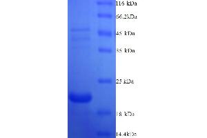 SDS-PAGE (SDS) image for Antigen Identified By Monoclonal Antibody Ki-67 (MKI67) (AA 3120-3256) protein (His tag) (ABIN4974674) (Ki-67 Protein (AA 3120-3256) (His tag))