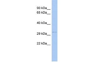 WB Suggested Anti-ODF4 Antibody Titration: 0.