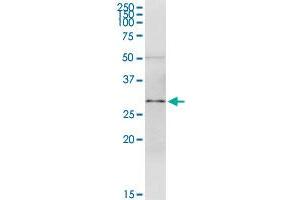 SPI1 MaxPab rabbit polyclonal antibody. (SPI1 antibody  (AA 1-264))